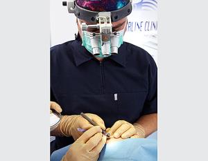 531 مركز أتش أل سي لزراعة الشعر